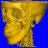medxray1
